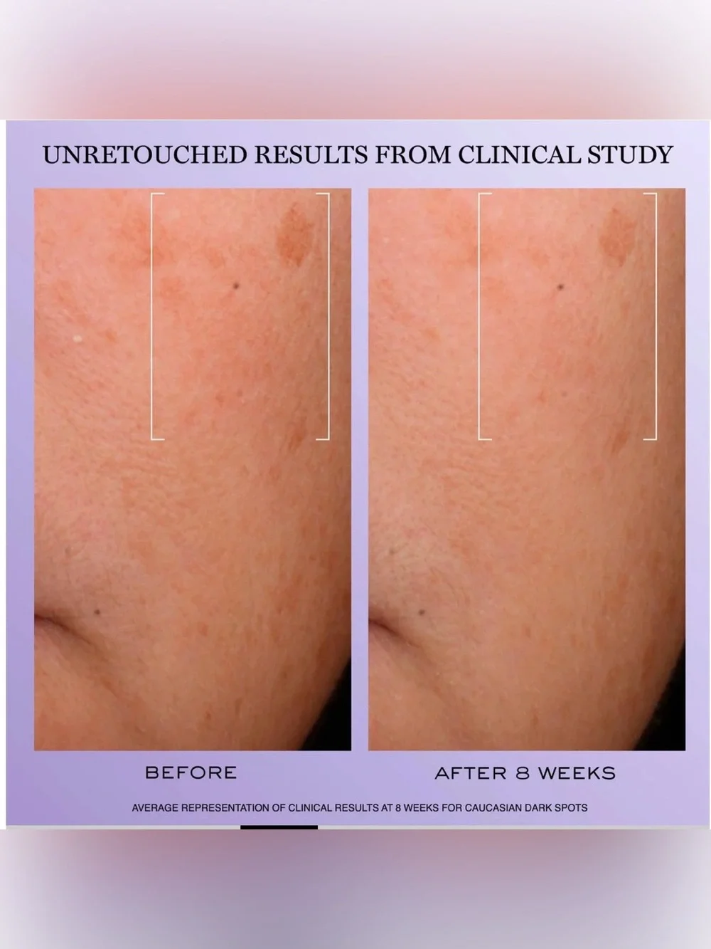 Lancôme Renergie HCF Triple Serum Plumping & Dark Spot Reducing